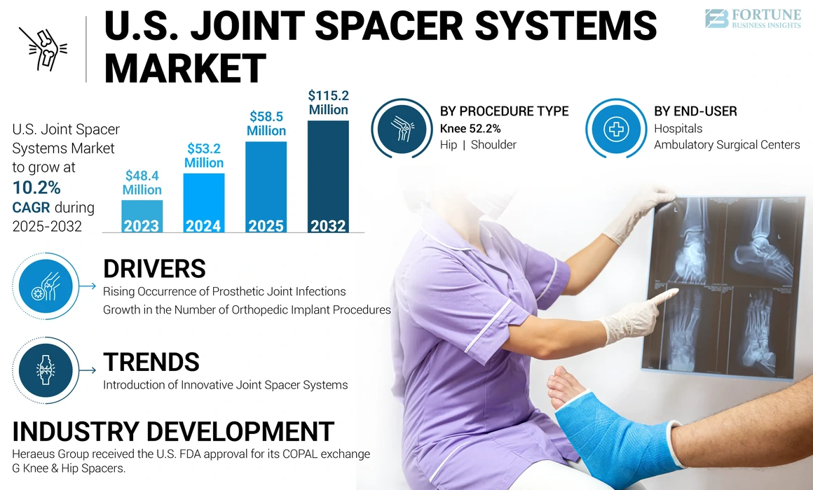 U.S. Joint Spacer Systems Market