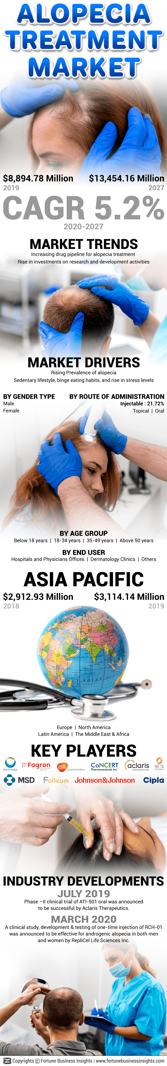 Alopecia Treatment Market