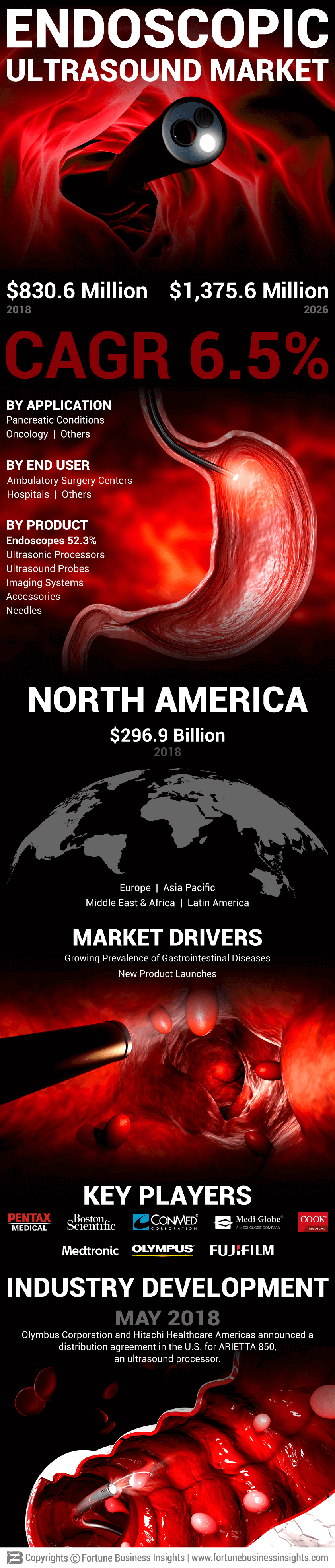 Endoscopy Ultrasound Market