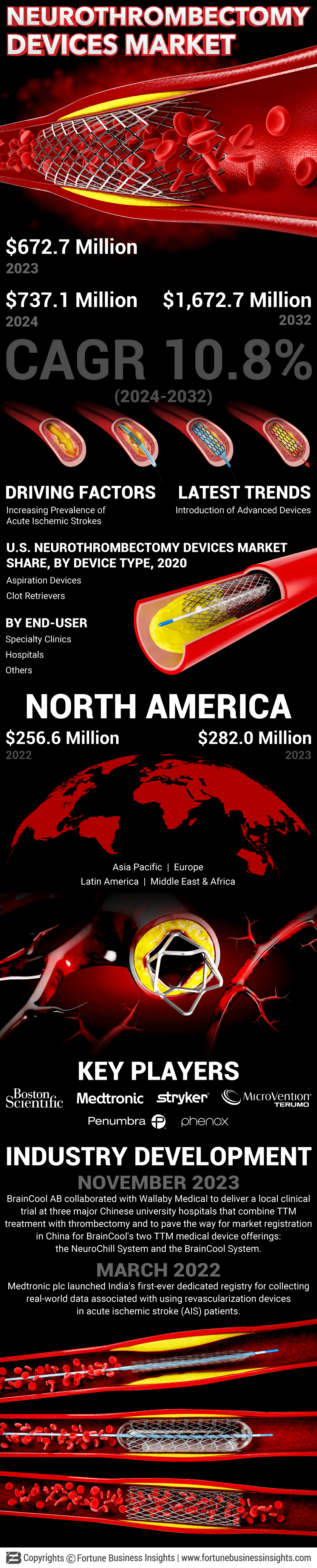 Neurothrombectomy Devices Market