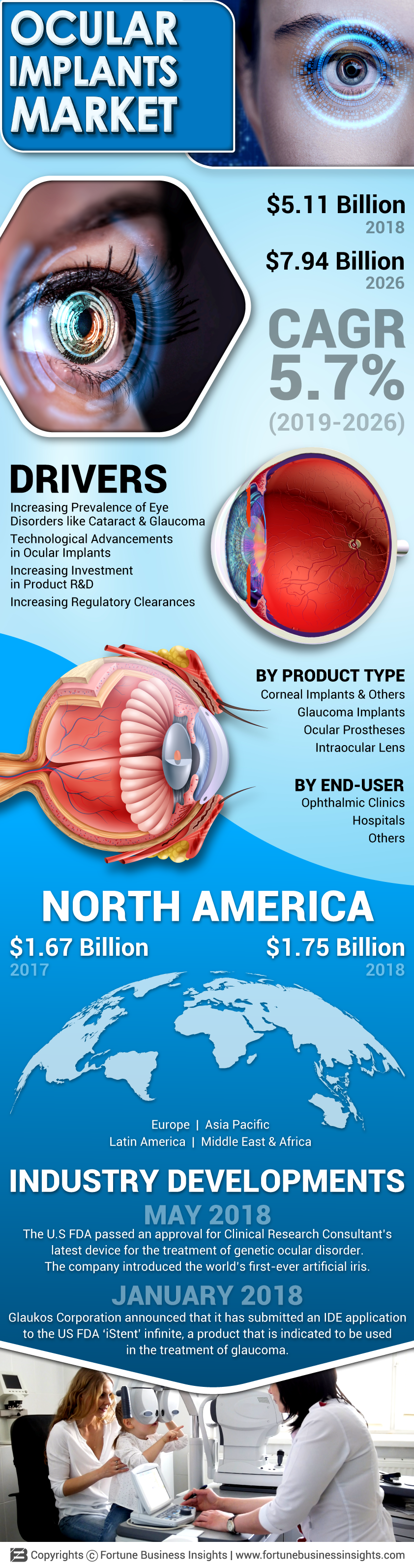 Ocular Implants Market