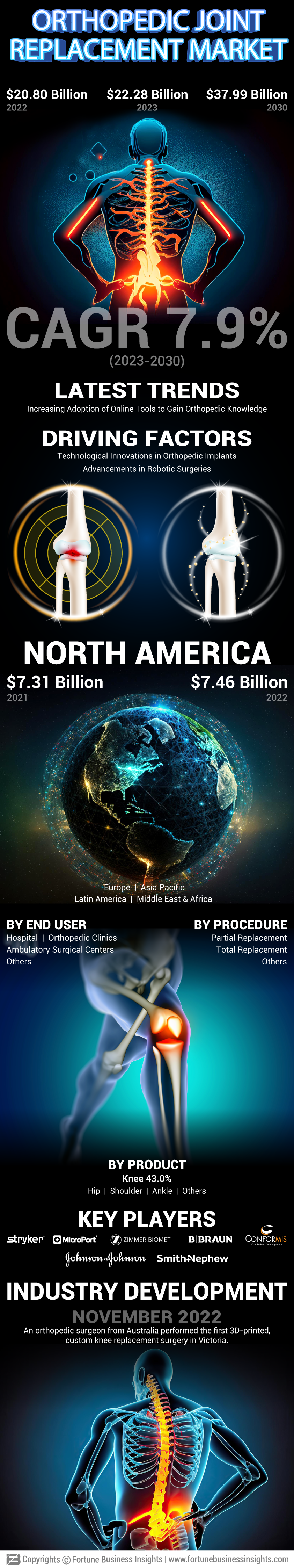 Orthopedic Joint Replacement Market