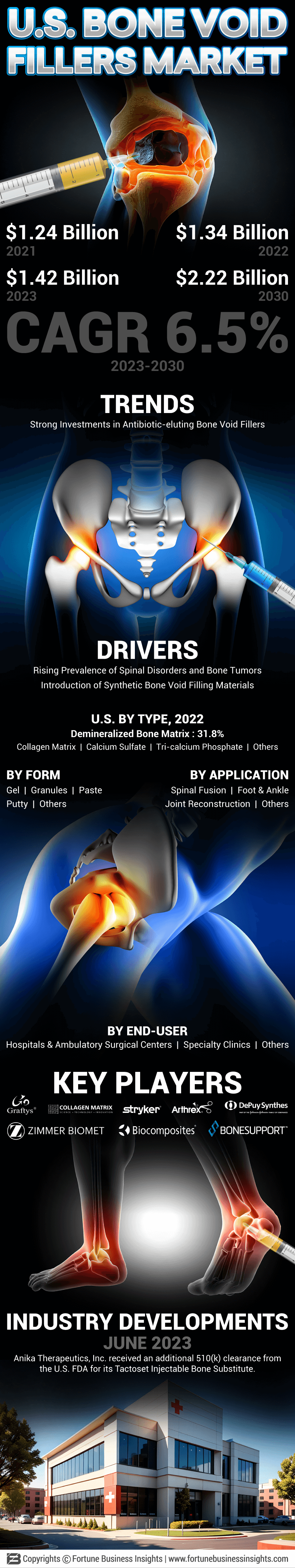 U.S. Bone Void Fillers Market