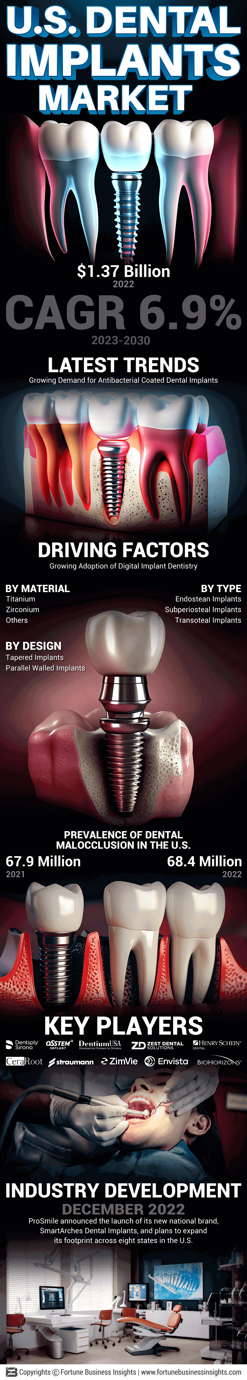 U.S. Dental Implants Market
