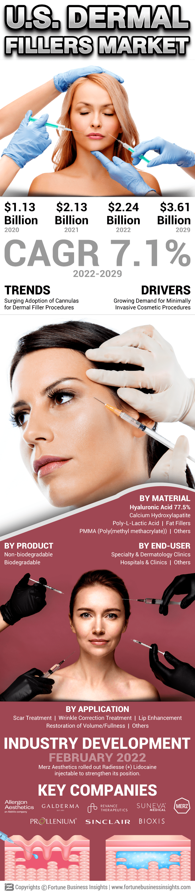 U.S. Dermal Fillers Market