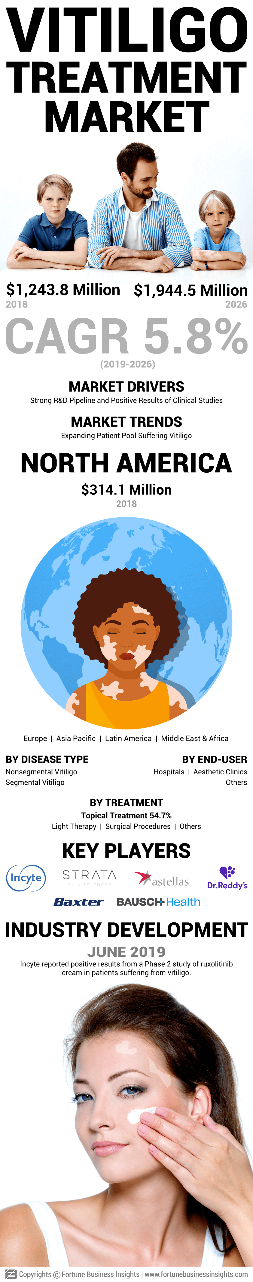 Vitiligo Treatment Market